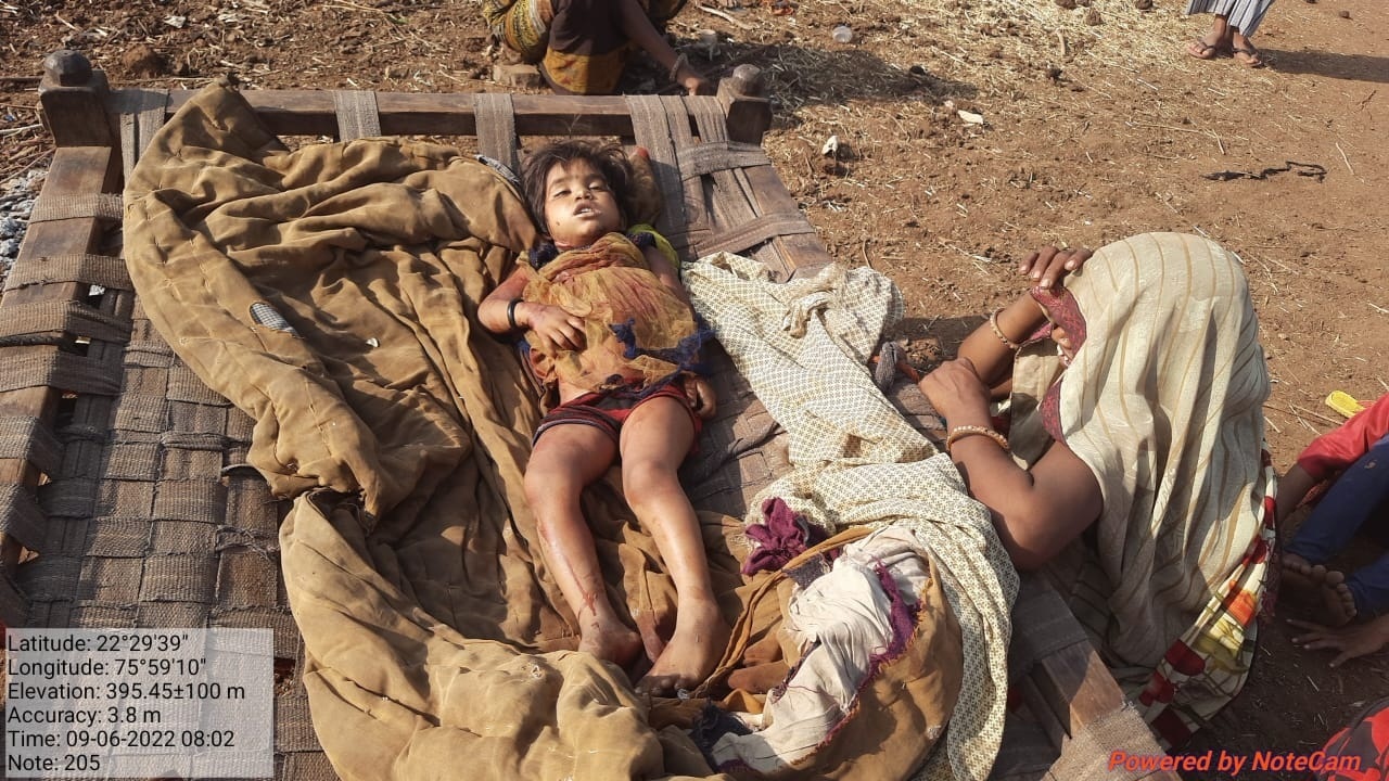 Leopard attacked a 7-year-old girl in Choral Mein village of Indore. Due to which the girl died. She was sleeping outside the hut with her mother at night